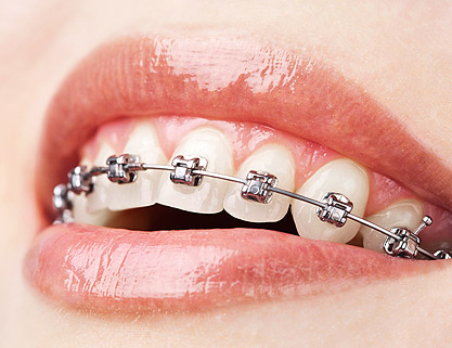 Orthodontics